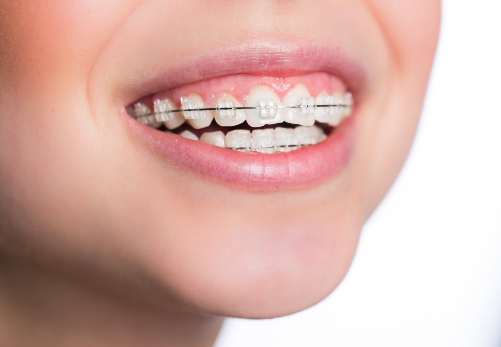 Sonrisa
